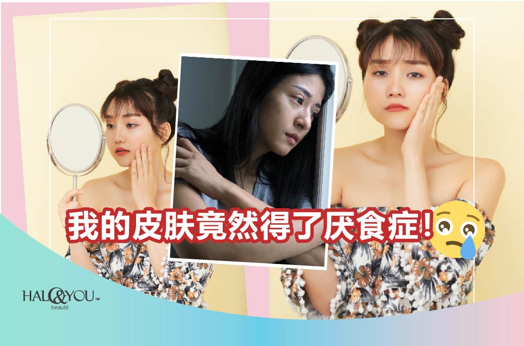 Halo & You | 心碎😢我的皮肤竟然得了厌食症!