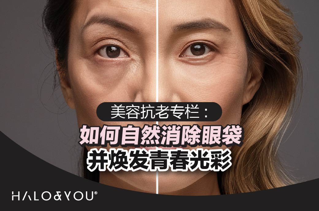 美容抗老专栏:如何自然消除眼袋并焕发青春光彩