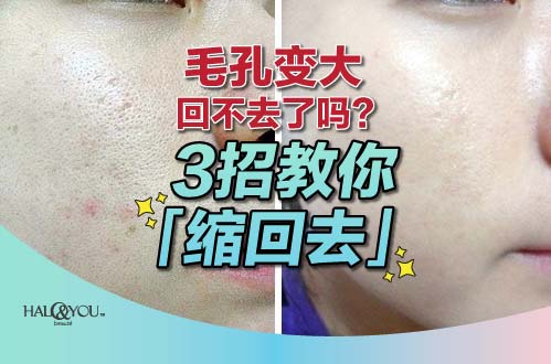 毛孔变大回不去了吗?3招教你「缩回去」| Halo & You