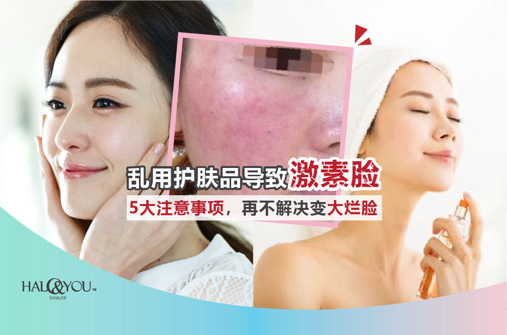 Halo & You | "激素脸"5大注意事项,再不解决就变大烂脸