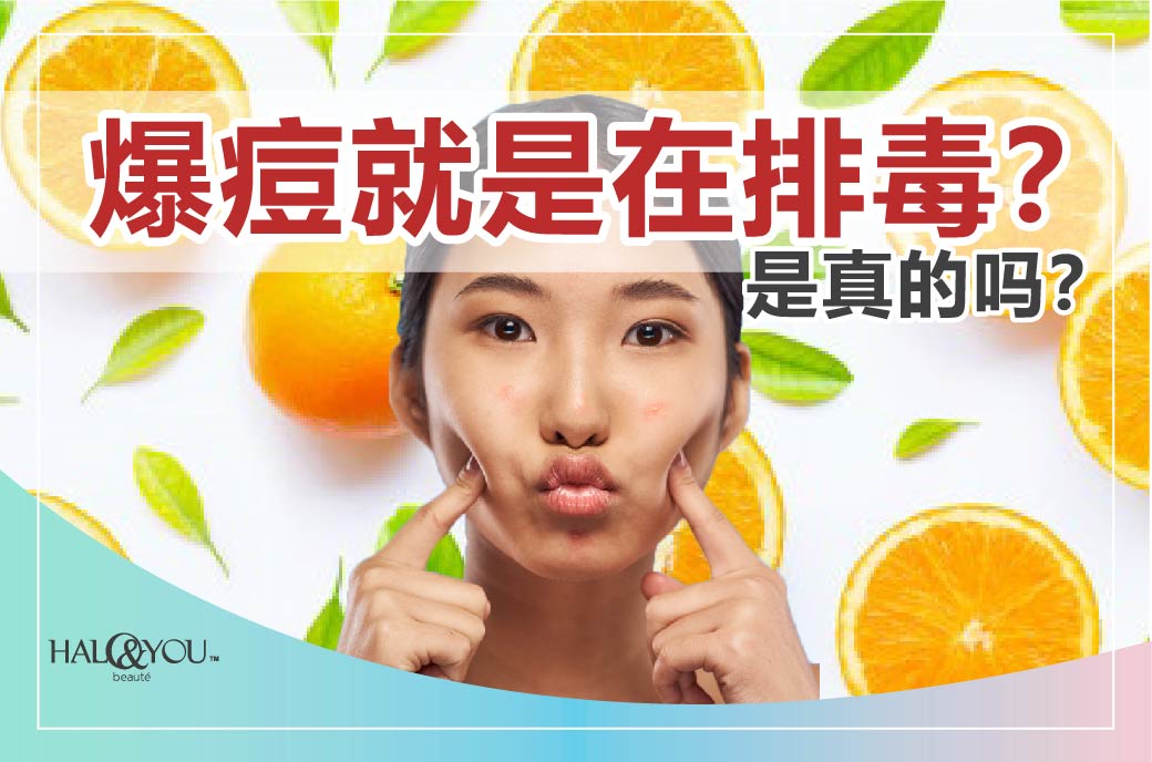 Halo & You | 爆痘就是在排毒?是真的吗?