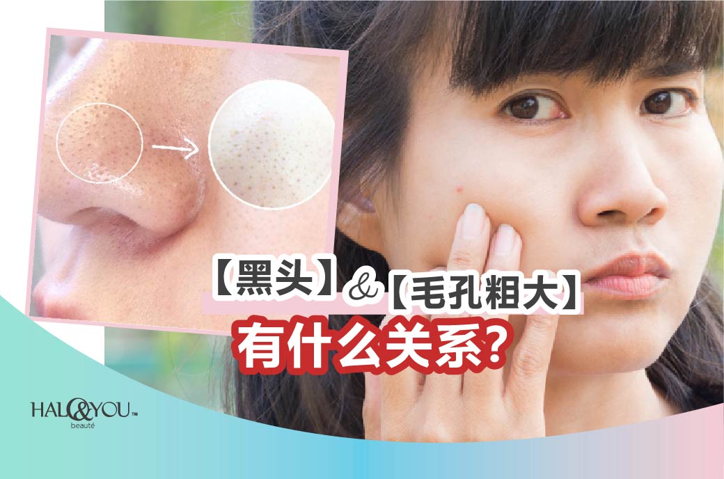 Halo & You | 🔎揭秘:【毛孔粗大】与【黑头】有什么关系?