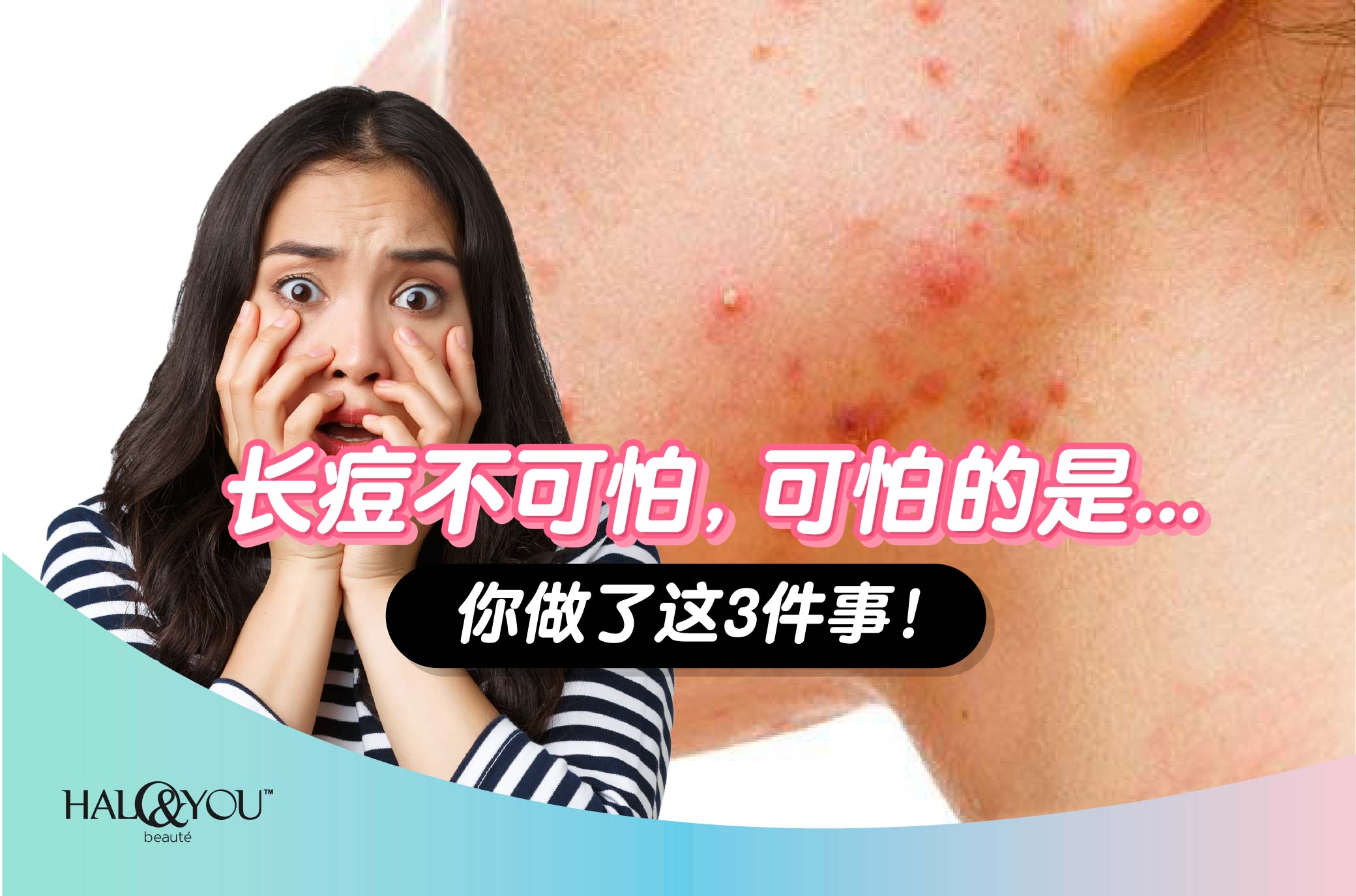 长痘不可怕,可怕的是你做了这3件事!【Halo & You】