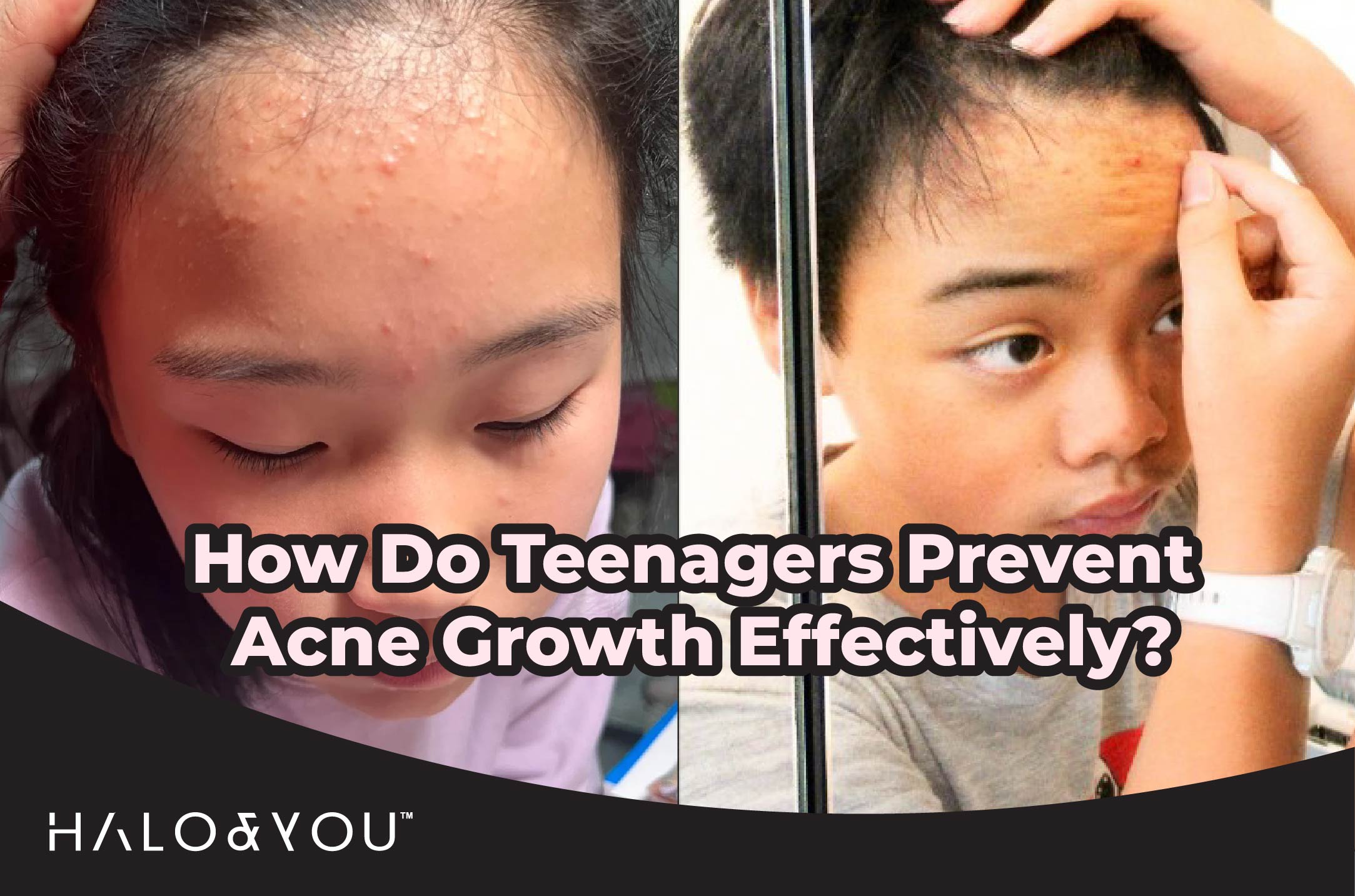 prevent teenage acne growth halo and you trio bio deep cleansing facial mask