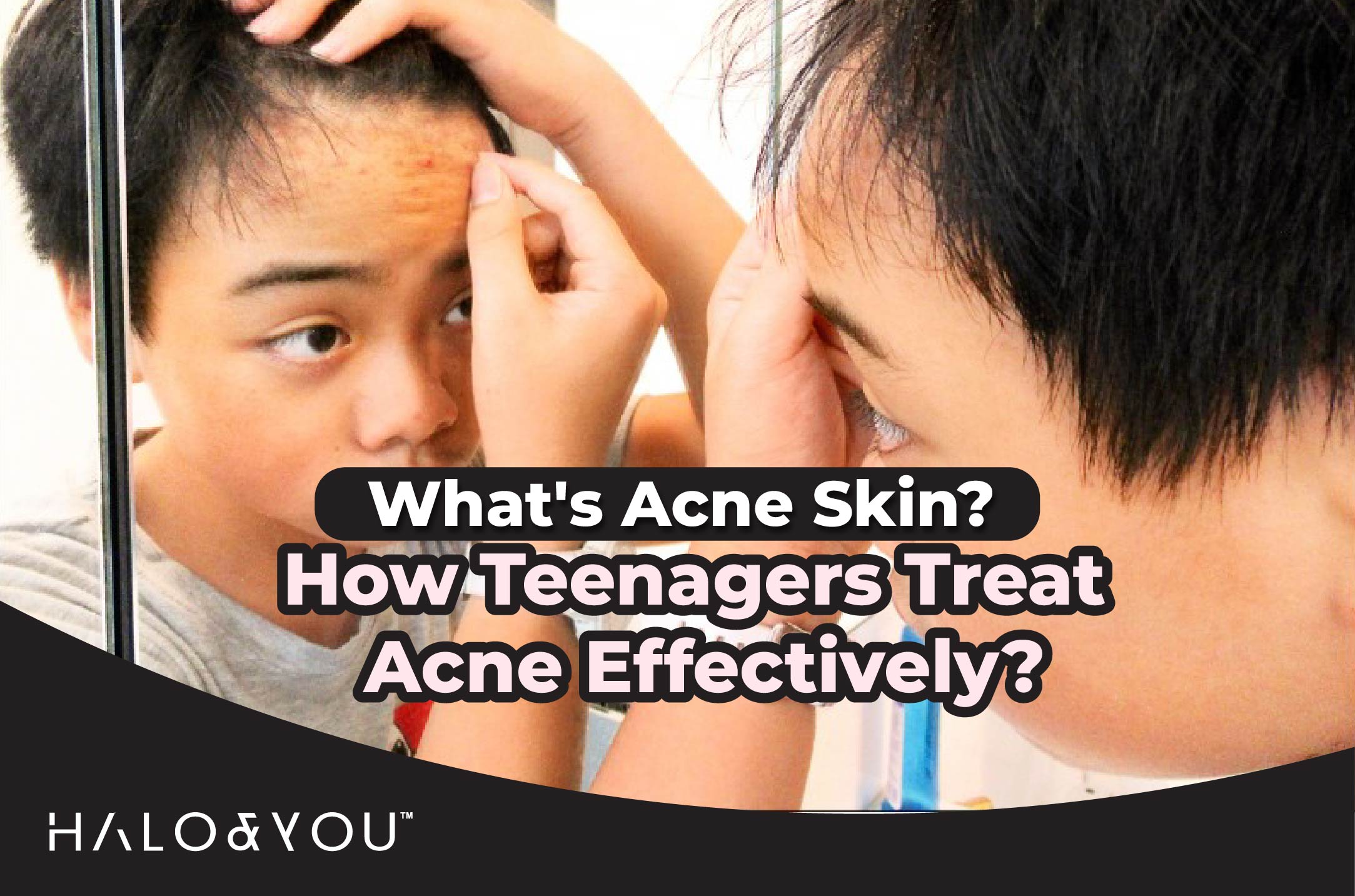 Treat Acne halo and you trio bio deep cleansing facial mask