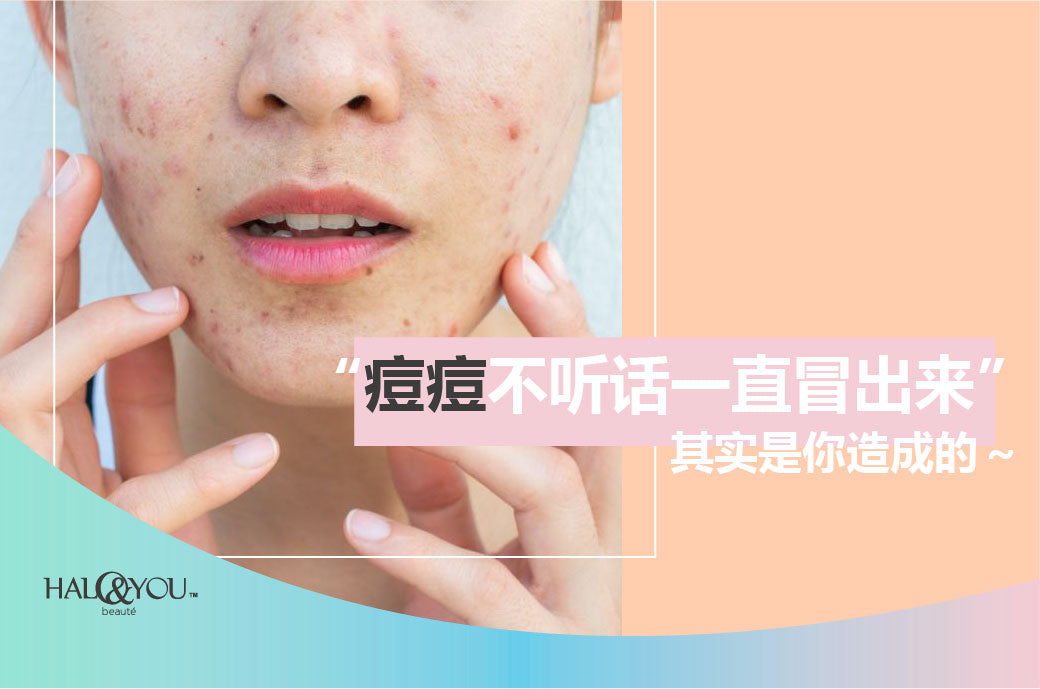 Halo and You | 痘痘不听话一直冒出来,其实是你造成的~
