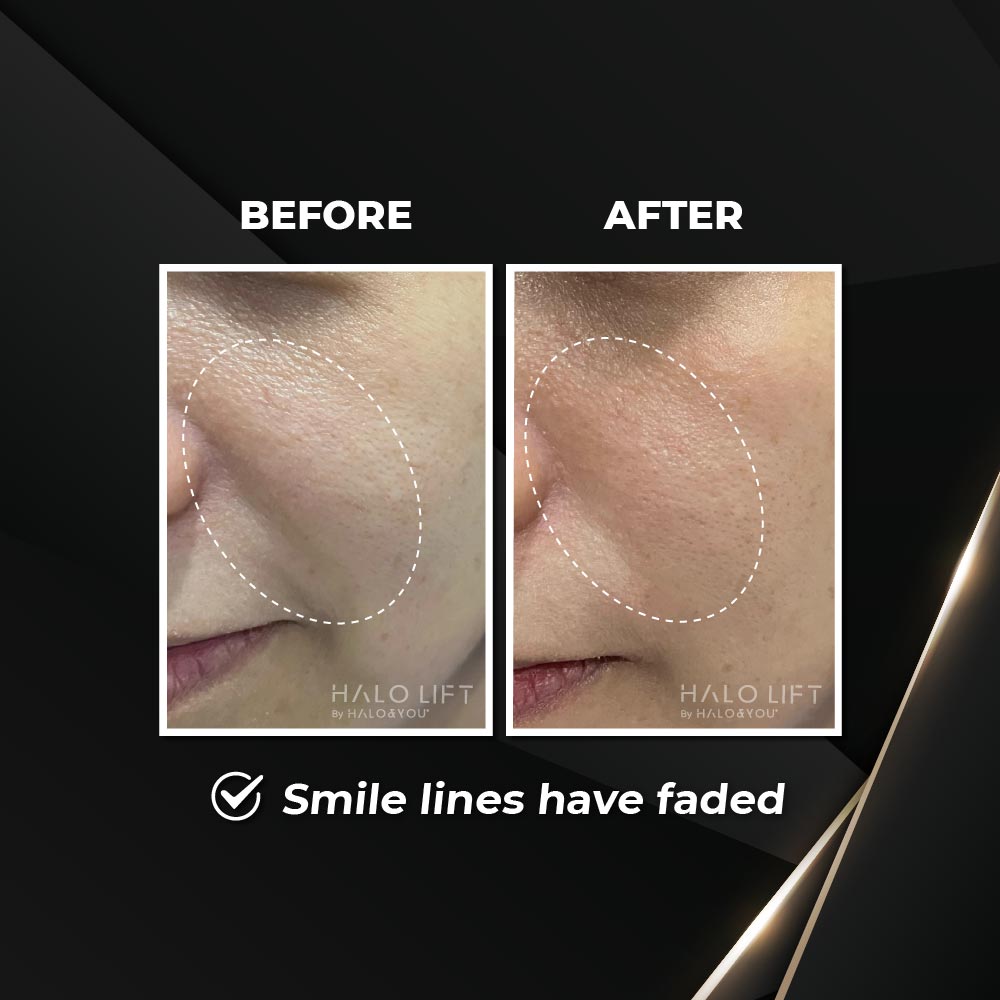 Halo Lift Firming Essence Mist