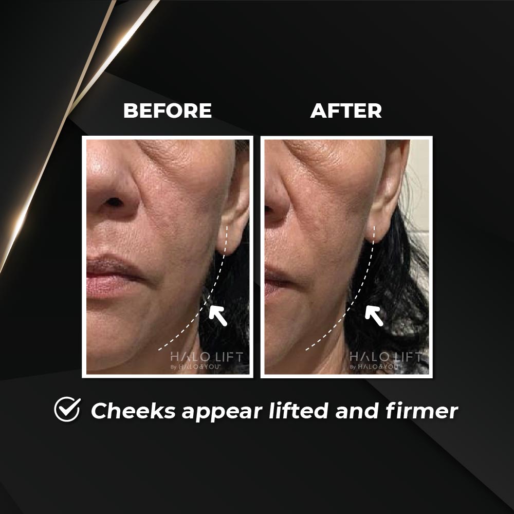 PRE-ORDER (BUY 1 FREE 1) Halo Lift Firming Essence Mist