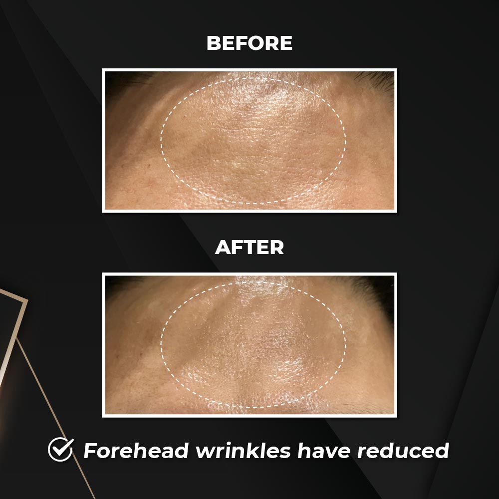 Halo Lift Firming Essence Mist