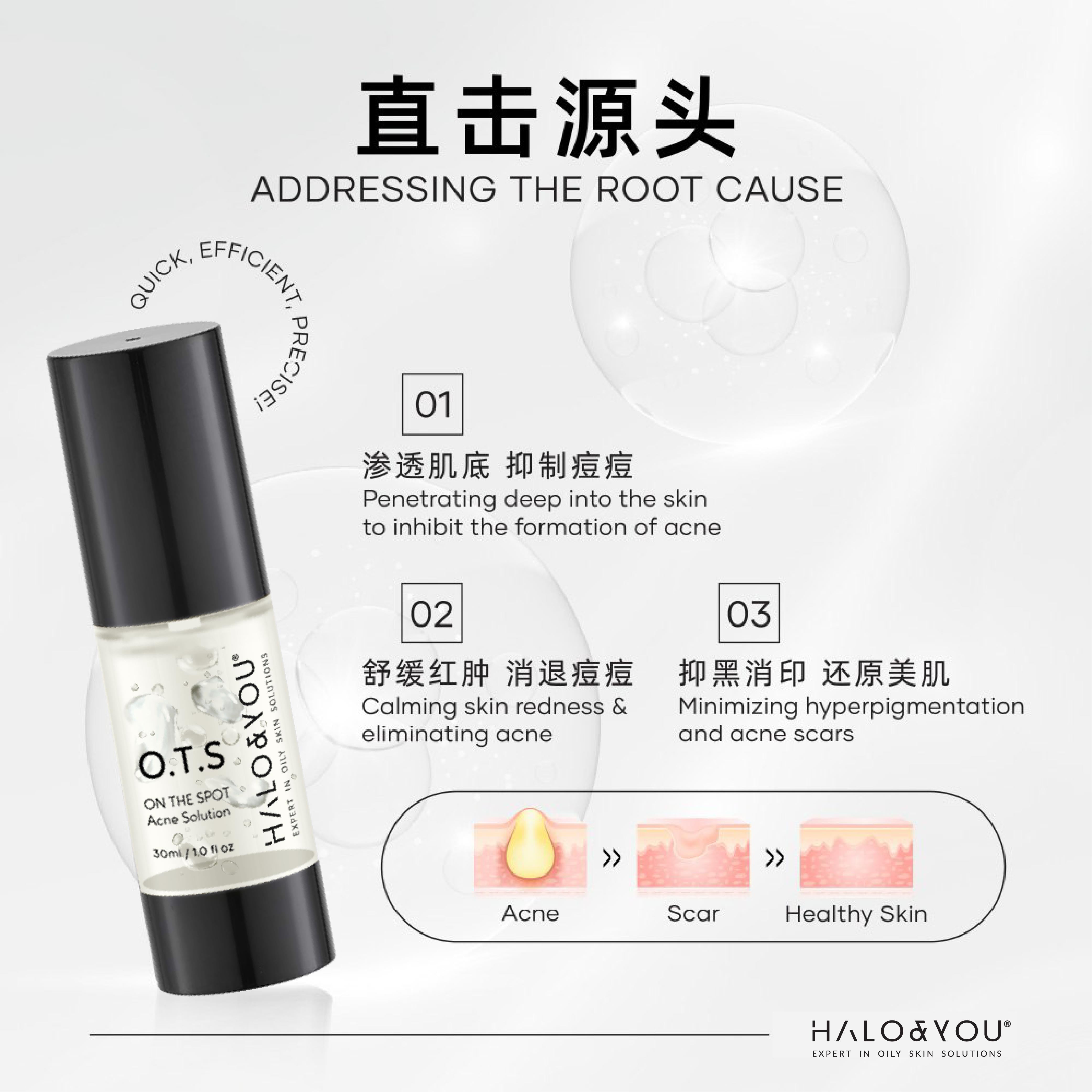 O.T.S On The Spot Acne Solution