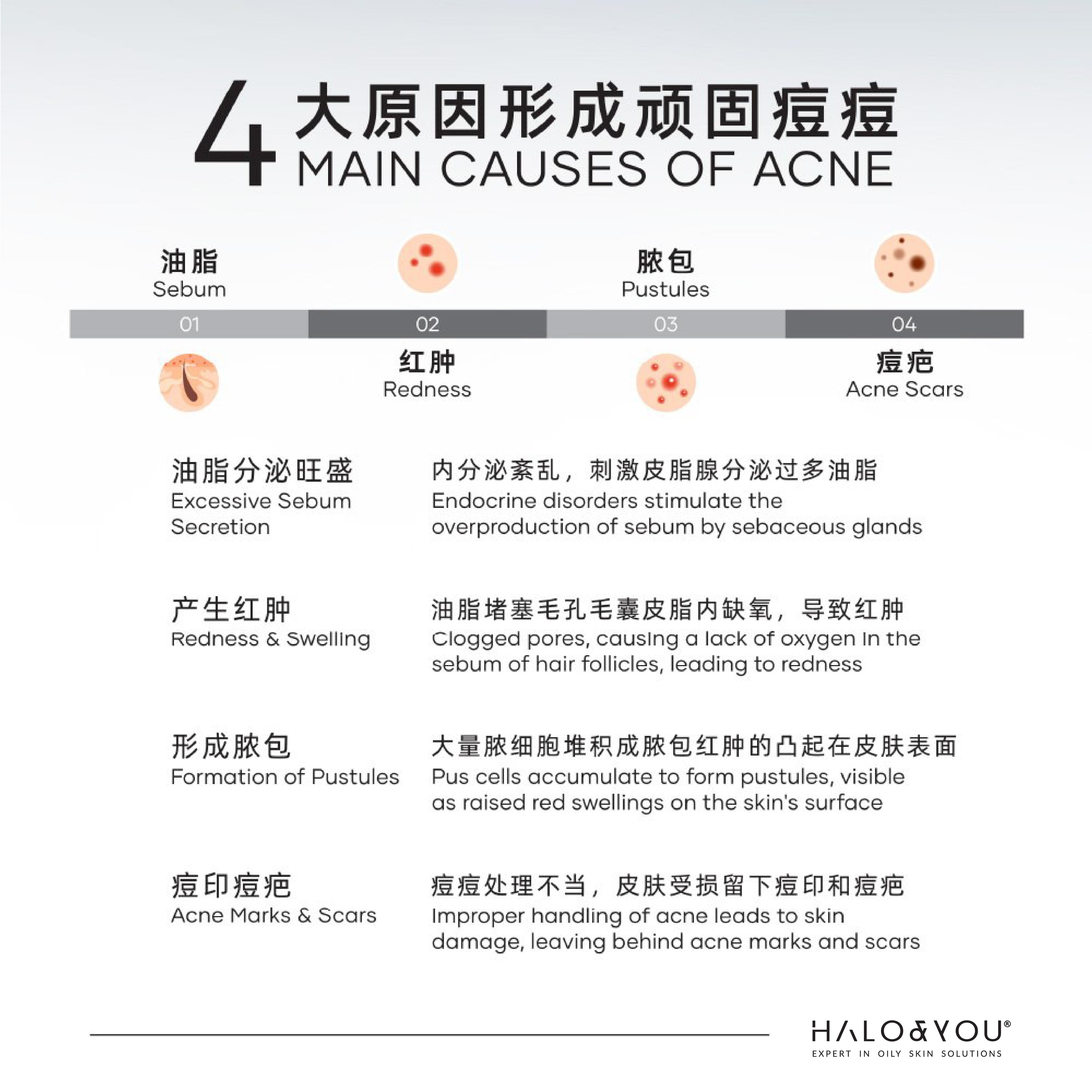 Bundle Deals - OTS On The Spot Acne Solution