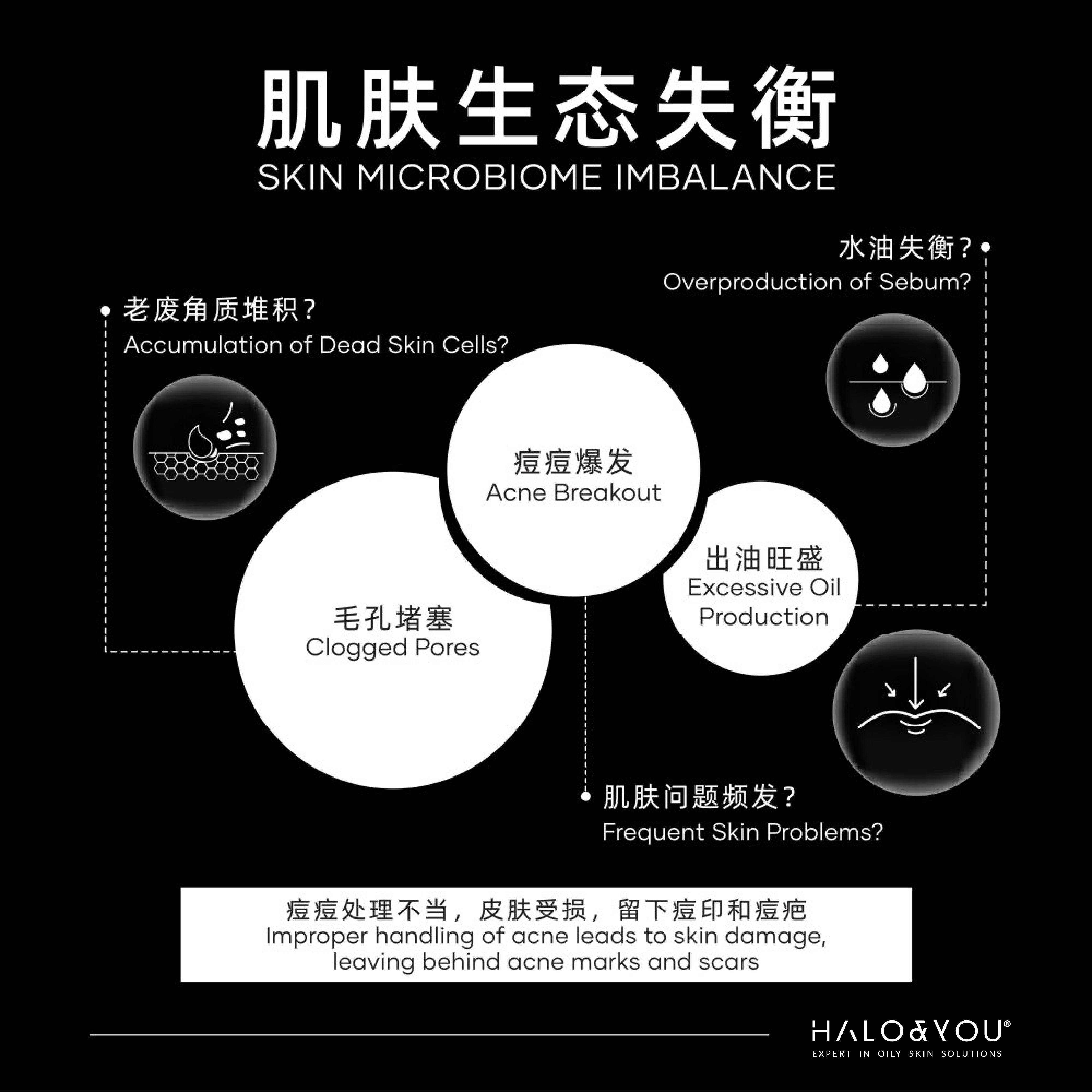 OTS玻尿酸祛痘GEL