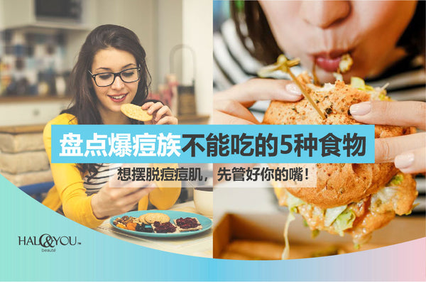 Halo & You | 想摆脱痘痘肌，先管好你的嘴！盘点爆痘族不能吃的5种食物